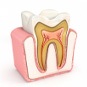 illustration of a what the interior of a tooth looks like