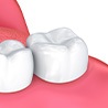 illustration of a wisdom tooth